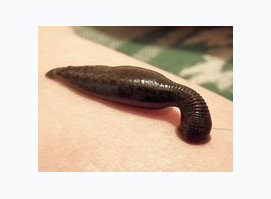 Продажа/Купить пиявок в ЦАО Продажа/Купить пиявок в ЦАО