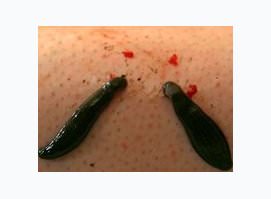 Продажа/Купить пиявок на Бульваре Рокоссовского